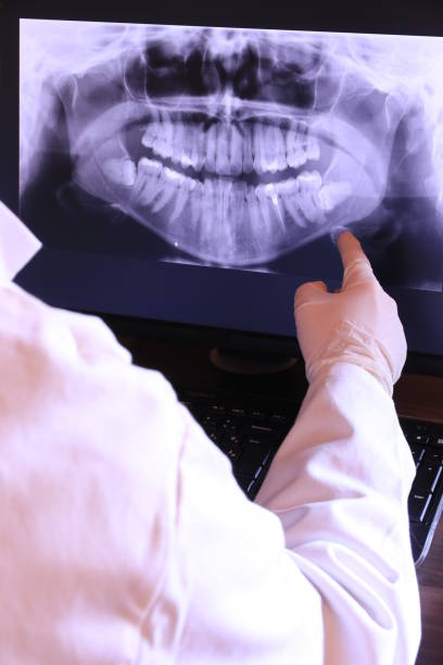 Best Emergency Dental Care for Broken or Chipped Teeth in Booker, TX