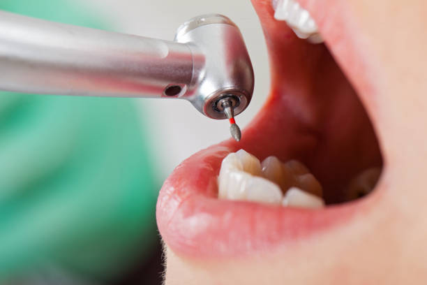 Best Emergency TMJ Treatment in Booker, TX